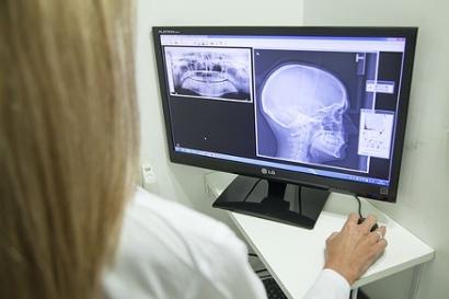 A nurse examining the xray of a skull